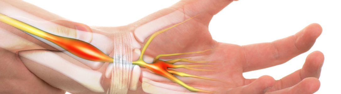 Hand Surgery Procedures